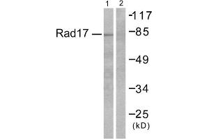 Western blot analysis of extracts from RAW264. (ABHD14A antibody  (C-Term))