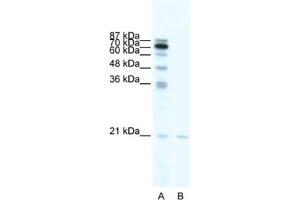 Western Blotting (WB) image for anti-SCAN Domain Containing 1 (SCAND1) antibody (ABIN2461245) (SCAND1 antibody)