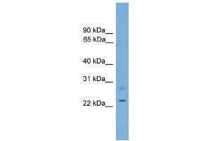WB Suggested Anti-RBM11 Antibody Titration: 0. (RBM11 antibody  (Middle Region))