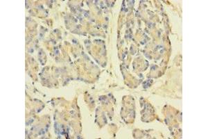 Immunohistochemistry of paraffin-embedded human pancreatic tissue using ABIN7149501 at dilution of 1:100 (APPL1 antibody  (AA 214-495))