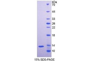 SDS-PAGE (SDS) image for Neurofilament, Light Polypeptide (NEFL) (AA 139-234) protein (His tag) (ABIN1099338)