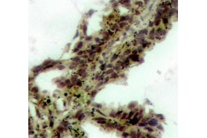 Immunohistochemistry (IHC) image for anti-V-Akt Murine Thymoma Viral Oncogene Homolog 1 (AKT1) (pThr308) antibody (ABIN1869972)