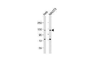 All lanes : Anti-TK Antibody (N-Term) at 1:2000 dilution Lane 1: Hela whole cell lysates Lane 2: NIH/3T3 whole cell lysates Lysates/proteins at 20 μg per lane. (AATK antibody  (AA 55-90))