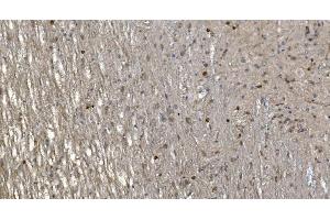 IHC analysis of Alpha B Crystallin/CRYAB using anti-Alpha B Crystallin/CRYAB antibody (ABIN7601209). (CRYAB antibody  (AA 30-151))