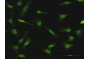 Immunofluorescence of purified MaxPab antibody to NME1 on HeLa cell. (NME1 antibody  (AA 1-177))
