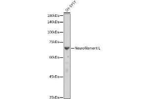 Western blot analysis of extracts of SH-SY5Y cells, using Neurofilament L antibody (ABIN7268867) at 1:10000 dilution. (NEFL antibody)