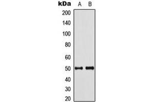 Western blot analysis of Septin 8 expression in HeLa (A), mouse brain (B) whole cell lysates. (Septin 8 antibody  (Center))