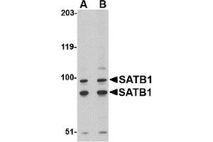 Western Blotting (WB) image for anti-SATB Homeobox 1 (SATB1) (C-Term) antibody (ABIN1030642) (SATB1 antibody  (C-Term))