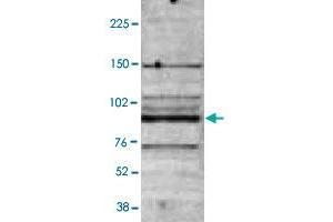 B : Western blot was performed on nuclear extracts from the U-937 (human leukemic monocyte lymphoma cell line ; 40 ug) with MBD4 polyclonal antibody , diluted 1 : 2,000 in TBST containing 3% milk powder.