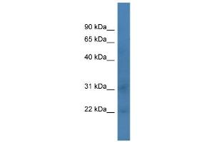 WB Suggested Anti-Taf12 Antibody Titration: 0. (TAF12 antibody  (C-Term))