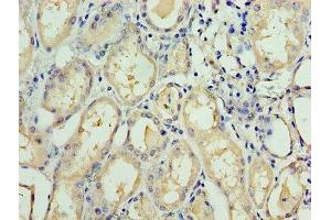 Immunohistochemistry of paraffin-embedded human kidney tissue using ABIN7171562 at dilution of 1:100 (TAF1C antibody  (AA 70-320))
