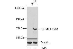 Western blot analysis of extracts from HeLa cells, using Phospho-LIMK1-T508 antibody (ABIN3020309, ABIN3020310, ABIN3020311, ABIN1681739 and ABIN7101871). (LIM Domain Kinase 1 antibody  (pThr508))