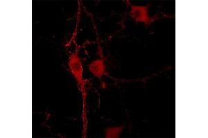 Immunocytochemistry on cultured hippocampus neurons (dilution 1 : 500).