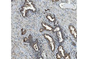 IHC analysis of RAB1B using anti-RAB1B antibody (ABIN7602809). (RAB1B antibody  (C-Term))