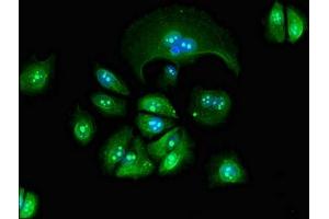 Immunofluorescent analysis of MCF-7 cells using ABIN7154424 at dilution of 1:100 and Alexa Fluor 488-congugated AffiniPure Goat Anti-Rabbit IgG(H+L) (GZMM antibody  (AA 98-243))