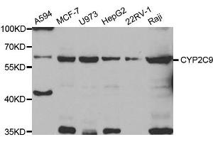 Western Blotting (WB) image for anti-Cytochrome P450, Family 2, Subfamily C, Polypeptide 9 (CYP2C9) antibody (ABIN1882346) (CYP2C9 antibody)