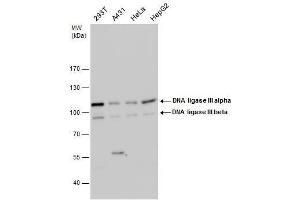 WB Image DNA ligase III antibody detects DNA ligase III protein by western blot analysis.
