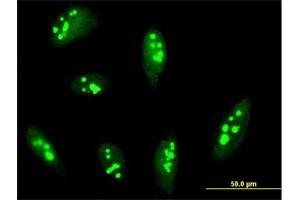 Immunofluorescence of purified MaxPab antibody to RRP12 on HeLa cell. (RRP12 antibody  (AA 1-1297))