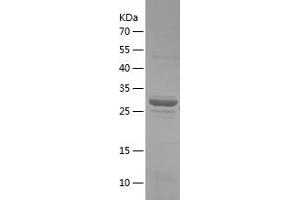 Western Blotting (WB) image for 14-3-3 gamma (YWHAG1) (AA 2-247) protein (His tag) (ABIN7283582) (14-3-3 gamma Protein (YWHAG1) (AA 2-247) (His tag))