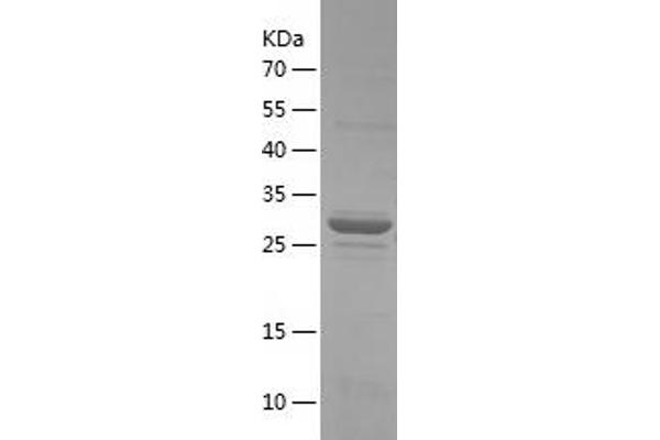 14-3-3 gamma Protein (YWHAG1) (AA 2-247) (His tag)