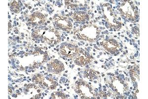 Arginase 1 antibody was used for immunohistochemistry at a concentration of 4-8 ug/ml to stain Alveolar cells (arrows) in Human Lung. (Liver Arginase antibody  (Arg1, N-Term))