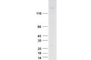 Western Blotting (WB) image for DNA Repair Protein Complementing XP-G Cells (ERCC5) protein (Myc-DYKDDDDK Tag) (ABIN2712283)