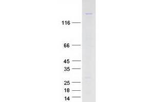 Validation with Western Blot