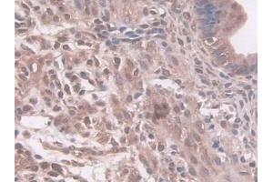 IHC-P analysis of Mouse Uterus Tissue, with DAB staining.