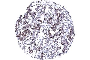 Immunohistochemistry (IHC) image for anti-Mucin 1 (MUC1) antibody (ABIN7477525)