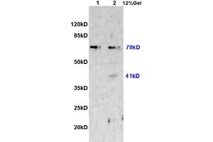 L1 rat heart lysates L2 rat brain lysates probed with Anti CX3CL1 Polyclonal Antibody, Unconjugated (ABIN728488) at 1:200 overnight at 4 °C.