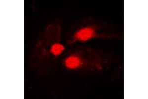 Immunofluorescent analysis of BTK (pY551) staining in Jurkat cells. (BTK antibody  (C-Term, pTyr551))