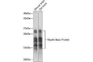 Western blot analysis of extracts of various cell lines, using Myelin Basic Protein Rabbit mAb (ABIN7268431) at 1:1000 dilution. (MBP antibody)
