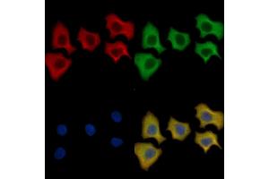 LRP6 Mouse Monoclonal Antibody staining HepG2 cells by IF/ICC.