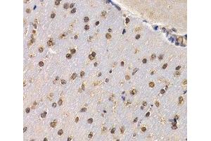 Immunohistochemistry of paraffin-embedded Mouse brain using RAD1 Polyclonal Antibody at dilution of 1:200 (40x lens). (RAD1 antibody)