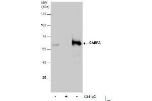 IP Image Immunoprecipitation of GABPA protein from 293T whole cell extracts using 5 μg of GABPA antibody [N2C2], Internal, Western blot analysis was performed using GABPA antibody [N2C2], Internal, EasyBlot anti-Rabbit IgG  was used as a secondary reagent.