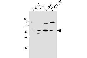 All lanes : Anti-FCGRT Antibody (C-term) at 1:500 dilution Lane 1: HepG2 whole cell lysate Lane 2: THP-1 whole cell lysate Lane 3: Human lung lysate Lane 4: COLO 205 whole cell lysate Lysates/proteins at 20 μg per lane.