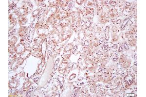 Formalin-fixed and paraffin embedded human kidney labeled with Anti-phospho-PIK3C3(Ser282) Polyclonal Antibody, Unconjugated (ABIN711656) at 1:200 followed by conjugation to the secondary antibody and DAB staining