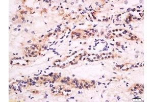 Formalin-fixed and paraffin embedded human kidney labeled with Anti-CXCL14 Polyclonal Antibody, Unconjugated  at 1:200 followed by conjugation to the secondary antibody and DAB staining. (CXCL14 antibody  (AA 51-99))