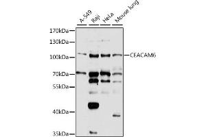 Western blot analysis of extracts of various cell lines, using CE antibody  at 1:1000 dilution. (CEACAM6 antibody  (AA 200-320))