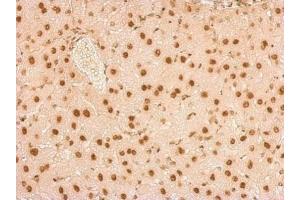 Immunohistochemistry (IHC) image for anti-Small Nuclear Ribonucleoprotein Polypeptide A (SNRPA) (C-Term) antibody (ABIN2855118)