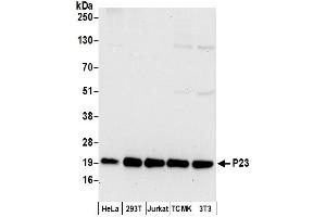 Western Blotting (WB) image for anti-Cyclin-Dependent Kinase 5, Regulatory Subunit 1 (p35) (CDK5R1) (AA 110-160) antibody (ABIN7453924)