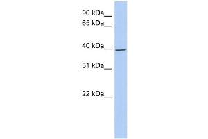 WB Suggested Anti-IKBKG Antibody Titration: 0. (IKBKG antibody  (N-Term))