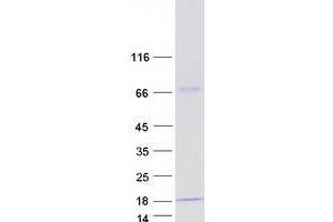 Validation with Western Blot (YPEL5 Protein (Transcript Variant 3) (Myc-DYKDDDDK Tag))