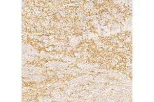 Immunohistochemistry analysis of paraffin embedded mouse cerebellum using Nrg4 (ABIN7074805) at dilution of 1: 300 (Neuregulin 4 antibody)