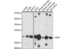 Western blot analysis of extracts of various cells, using SSR3 antibody (ABIN7270298) at 1:1000 dilution. (SSR3 antibody  (AA 70-145))