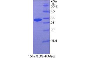 SDS-PAGE (SDS) image for Electron-Transfer-Flavoprotein, alpha Polypeptide (ETFA) (AA 34-295) protein (His tag) (ABIN1877307) (ETFA Protein (AA 34-295) (His tag))