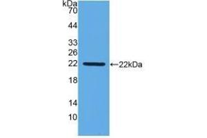 Detection of Recombinant IFNb, Gallus using Monoclonal Antibody to Interferon Beta (IFNb) (IFNB1 antibody  (AA 27-203))