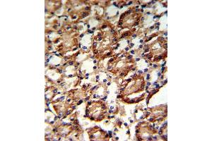 Immunohistochemistry (IHC) image for anti-Guanine Monophosphate Synthetase (GMPS) antibody (ABIN3001740) (GMP Synthase antibody)