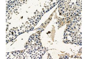 ABIN7096508 and ABIN7100572 at 1/100 staining mouse testis tissue by IHC-P. (RMDN3 antibody)