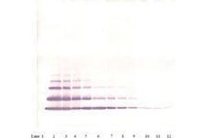 Image no. 2 for anti-Chemokine (C-X-C Motif) Ligand 2 (CXCL2) antibody (ABIN465915) (CXCL2 antibody)